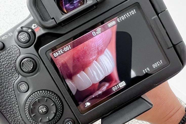 عکاسی دندانپزشکی